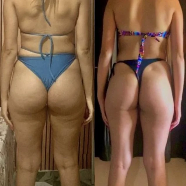 Antes e depois real de aluna da Consultoria Online HERO — resultado 7
